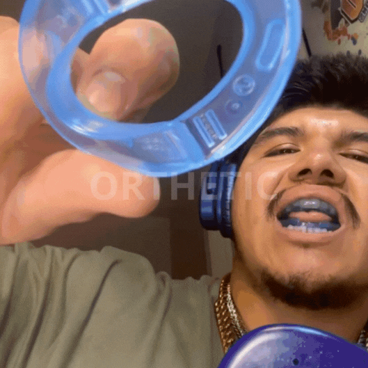 RonquidoZero® – Innovación para un Sueño de Calidad